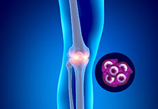 Autologous Mesenchymal Stem Cells