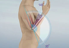 Elbow Contracture