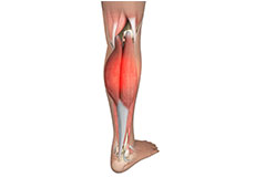 Medial Gastrocnemius Strain