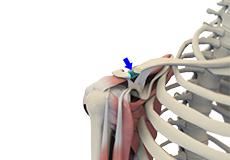 Arthroscopic Distal Clavicle Excision